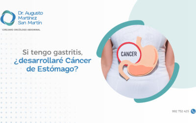 Si tengo gastritis, ¿desarrollaré cáncer de estómago?