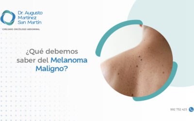 ¿Qué debemos saber del Melanoma Maligno?